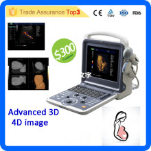 MSLCU28i good image function portable color doppler 4d ultrasound machine
